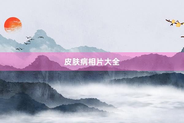 皮肤病相片大全